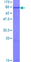 12.5% SDS-PAGE Stained with Coomassie Blue.